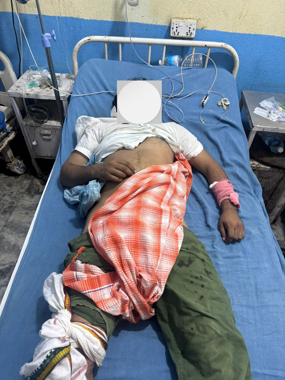 २२ महिनापछि फरार अभियुक्त पक्राउ : प्रहरीमाथि गोली चलाएपछि जवाफी फायरिङमा घाइते